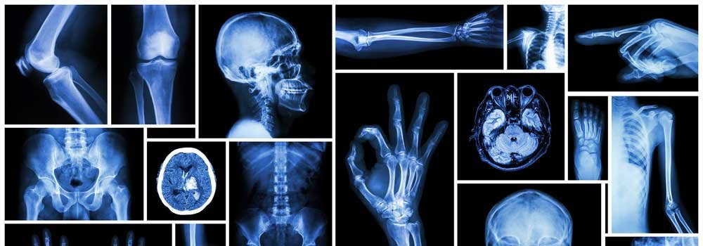 X-Rays-on-DependableBlog
